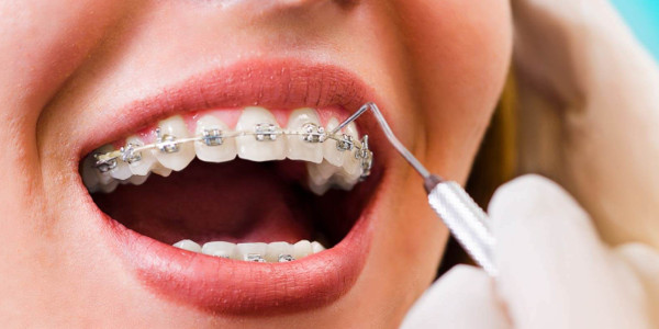 Ortodontia Com Capacitação Em Alinhadores e Mini-Implantes Ortodônticos